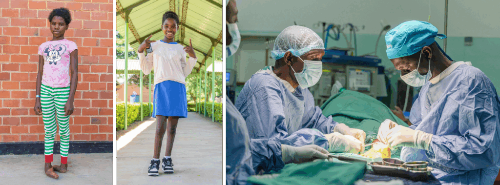 Three-part photo series: a girl standing before surgery, the same girl smiling and giving thumbs up after surgery, and surgeons operating in a hospital room.