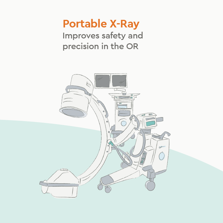 Illustration of a Portable X-Ray (C-Arm) machine used for surgical imaging and precision.