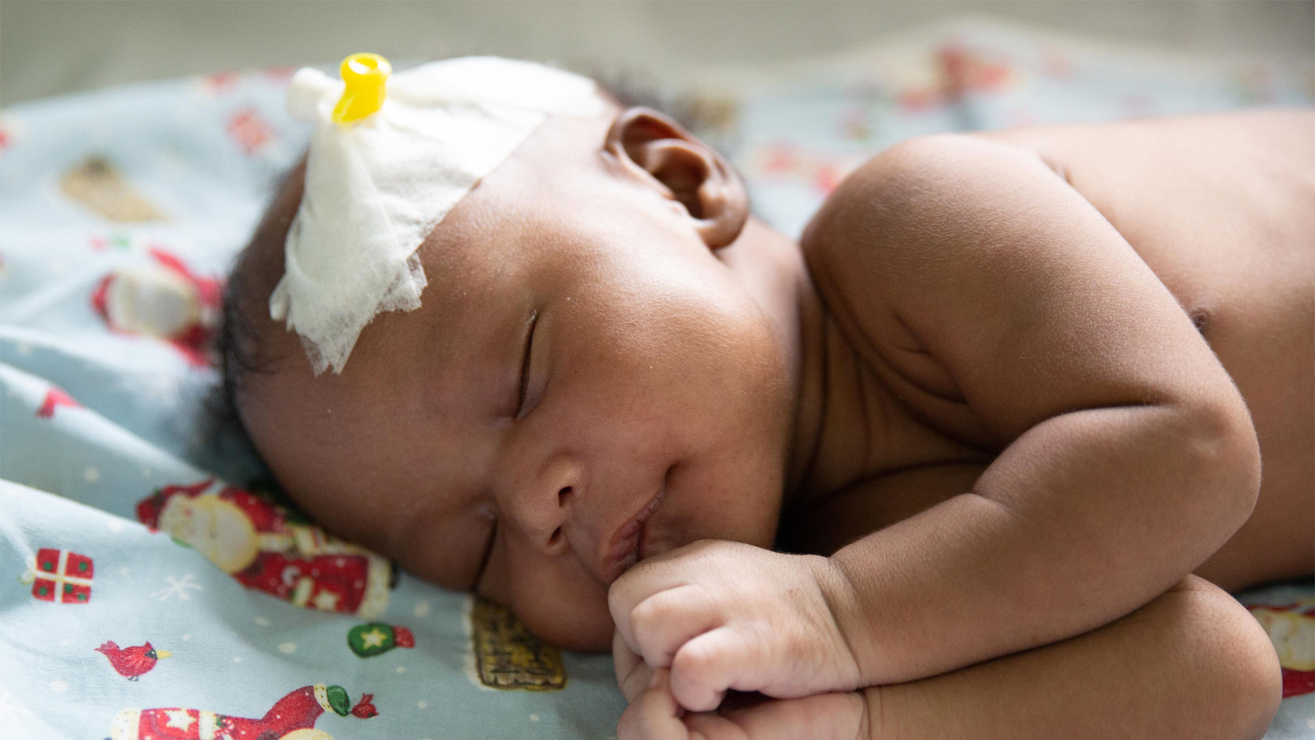 Endoscopic treatment versus shunting for infant hydrocephalus in Uganda