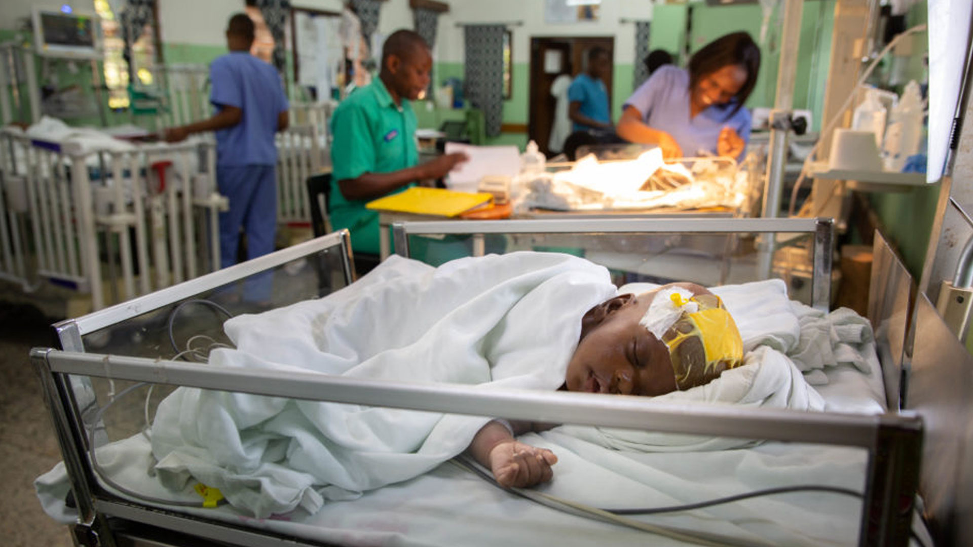 The incidence of postoperative seizures following treatment of postinfectious hydrocephalus in Ugandan Infants: A post hoc comparison of endoscopic treatment vs shunt placement in a randomized controlled trial