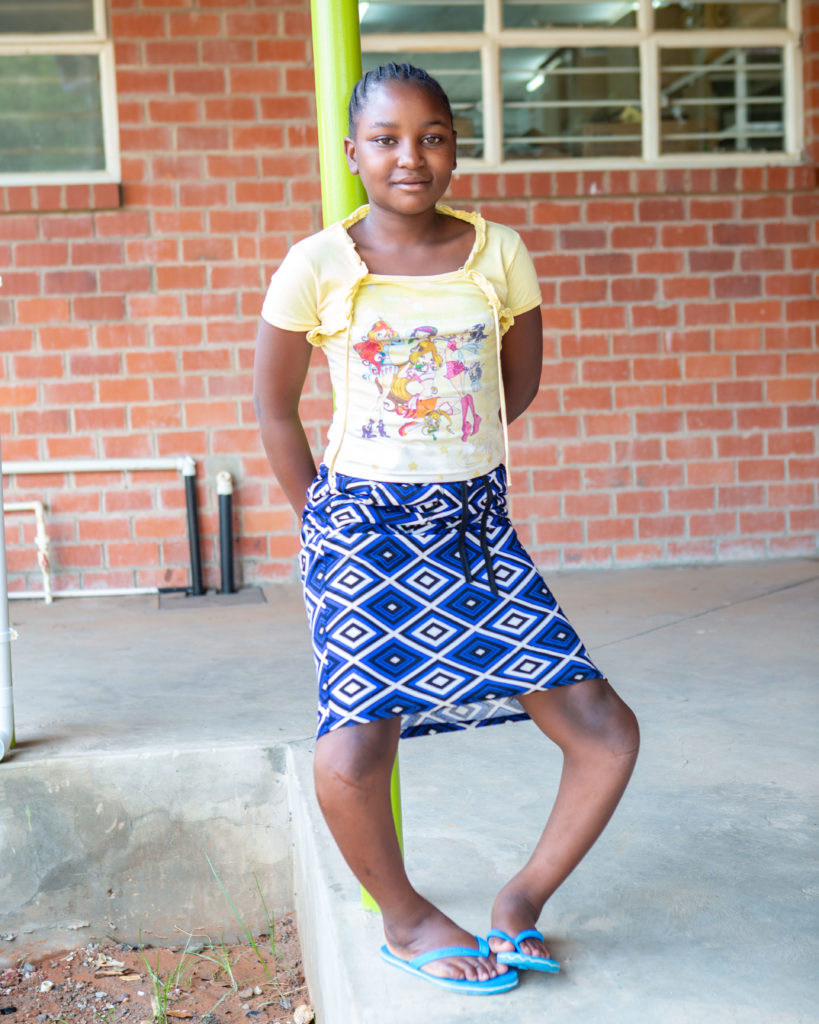 Smiling Young Girl with Bowed Legs