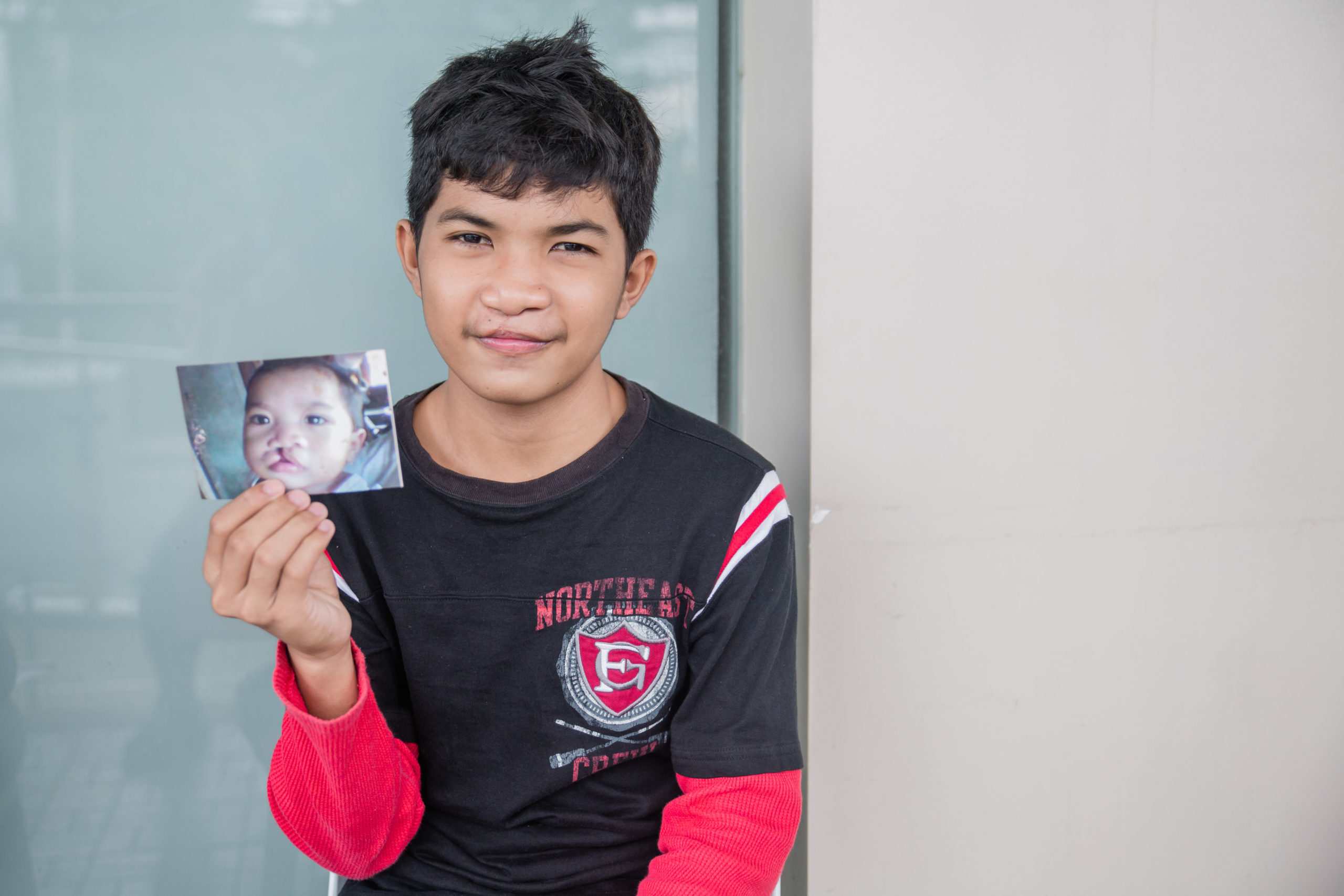 A New Smile for Joshua