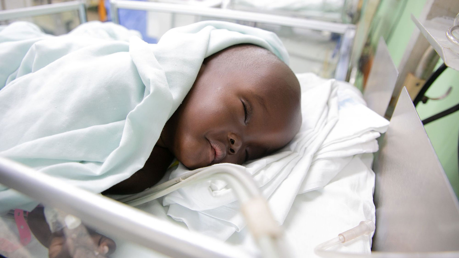 Factors affecting the survival of infants myelomeningocele in southeastern Uganda