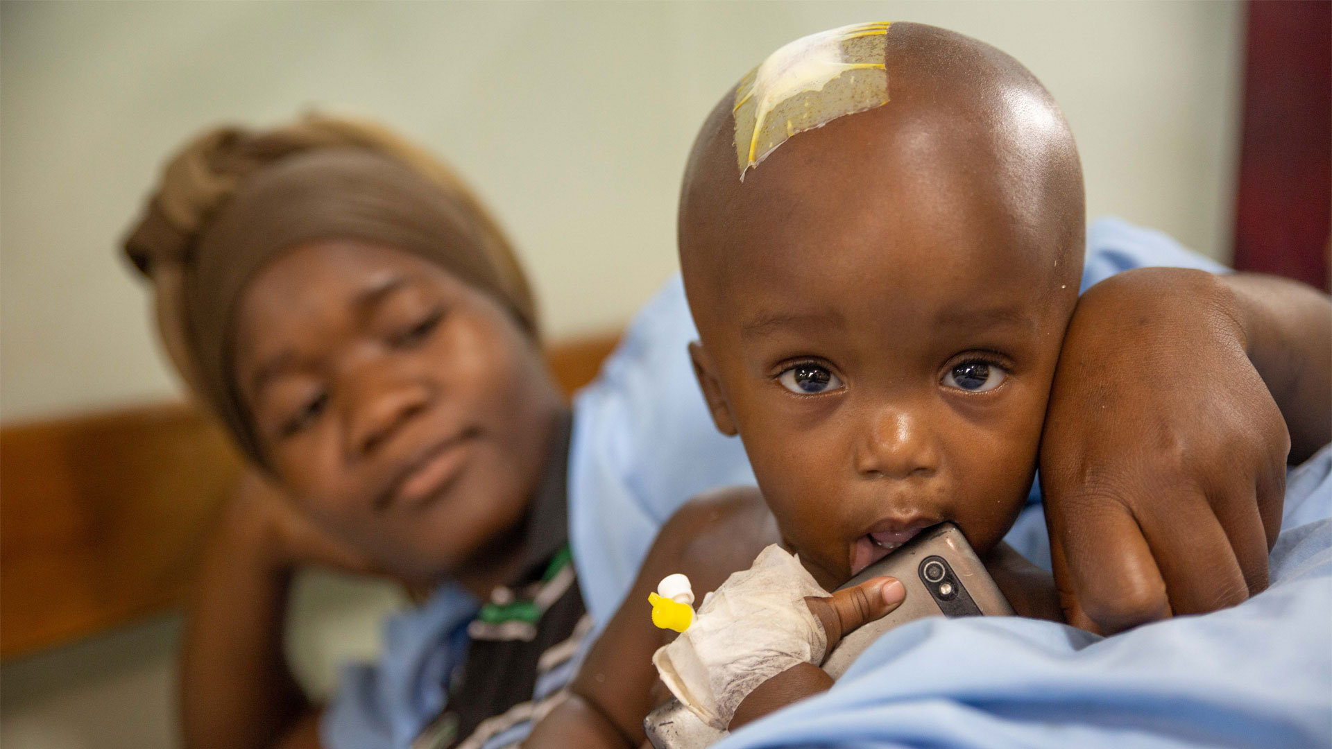 Pediatric Hydrocephalus in East Africa: Prevalence, Causes, Treatments, and Strategies for the Future
