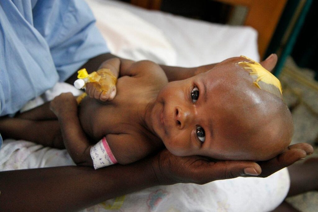 CURE Uganda serves as the hands and feet of Christ to children and babies in need of lifesaving care.