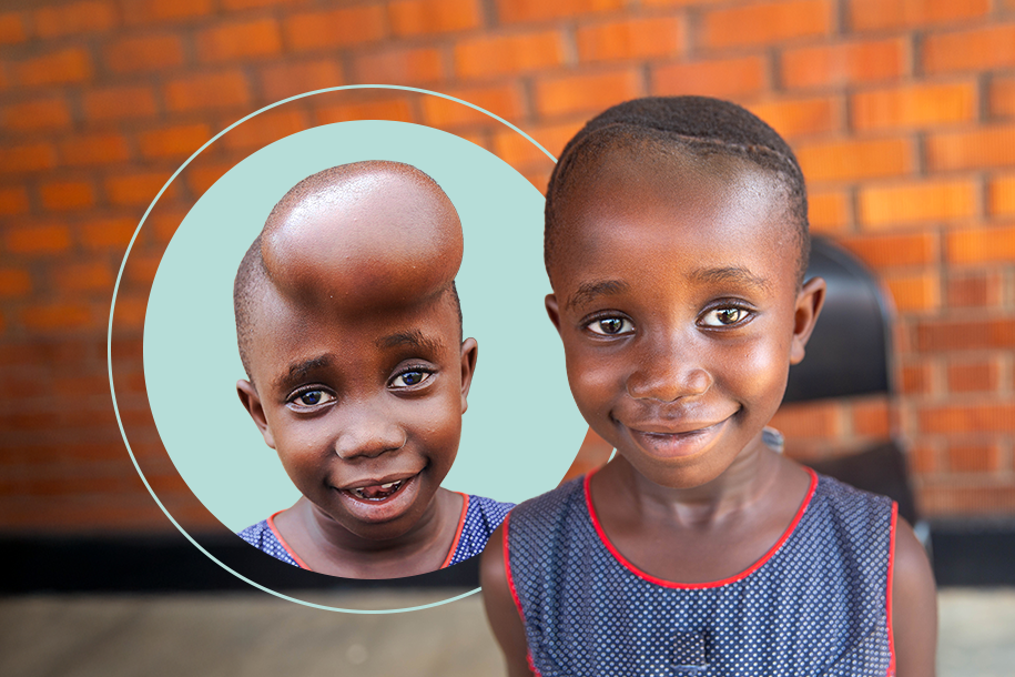 Urgent Brain Surgery