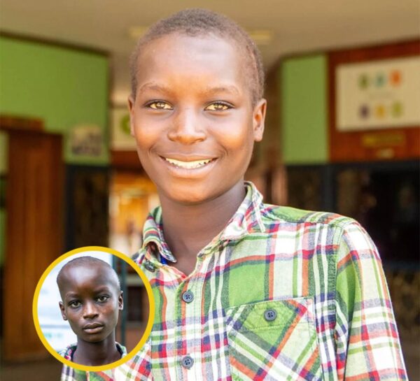 Boy smiling after brain surgery