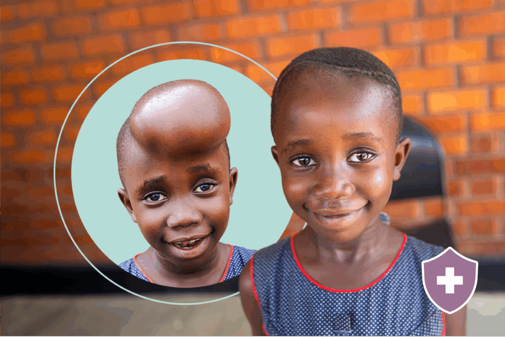 Urgent Brain Surgery