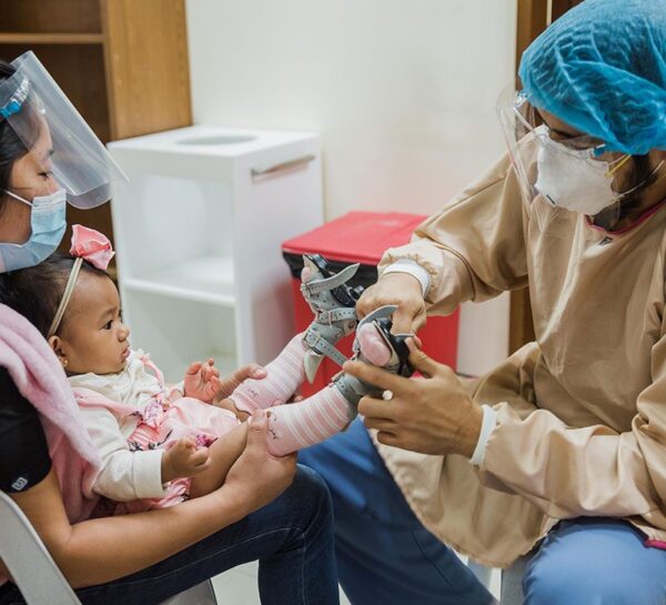 infant with clubfoot