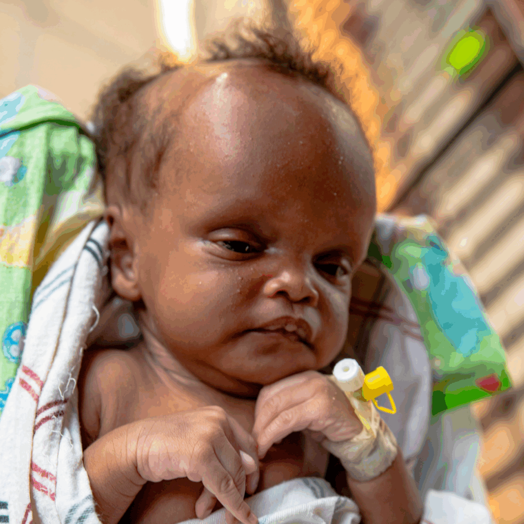 A close-up photograph of a newborn baby, possibly a few weeks old, with dark skin and dark, wispy hair. The baby's head appears relatively large compared to the rest of the face. They are wrapped partially in a white and green patterned blanket. A small intravenous (IV) cannula, with a yellow connector and white cap, is taped to the baby's left forearm. The background is softly blurred with warm, bright lighting, possibly suggesting an indoor or shaded outdoor setting. The baby's expression is serious or contemplative.